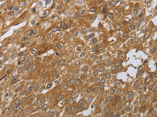 PTPRM Polyclonal Antibody Store at -20°C - Biomarkers - Elabscience Biotechnology - MSE Supplies