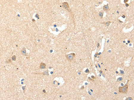 RRAD Polyclonal Antibody Store at -20°C - Biomarkers - Elabscience Biotechnology - MSE Supplies
