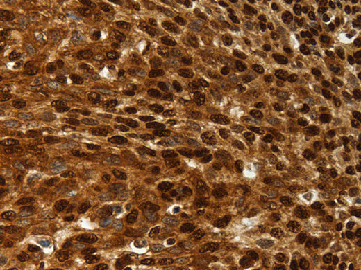 SCN1A Polyclonal Antibody Store at -20°C - Biomarkers - Elabscience Biotechnology - MSE Supplies