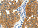 SCN9A Polyclonal Antibody Store at -20°C