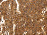 SCN11A Polyclonal Antibody Store at -20°C