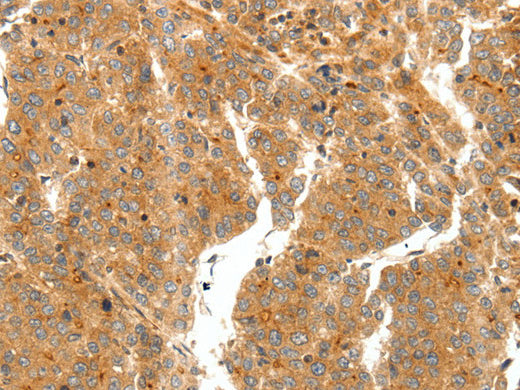 SCT Polyclonal Antibody Store at -20°C - Biomarkers - Elabscience Biotechnology - MSE Supplies