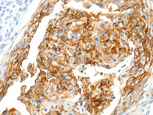 SEMA3D Polyclonal Antibody Store at -20°C - Biomarkers - Elabscience Biotechnology - MSE Supplies