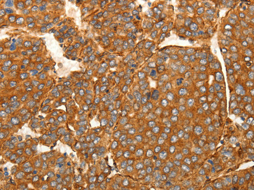 SFRP1 Polyclonal Antibody Store at -20°C - Biomarkers - Elabscience Biotechnology - MSE Supplies