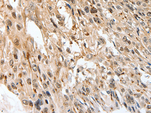 SLC1A7 Polyclonal Antibody Store at -20°C - Biomarkers - Elabscience Biotechnology - MSE Supplies