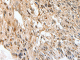 SLC1A7 Polyclonal Antibody Store at -20°C