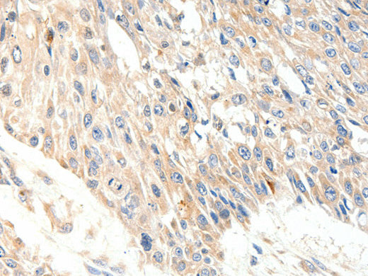 SLC27A1 Polyclonal Antibody Store at -20°C - Biomarkers - Elabscience Biotechnology - MSE Supplies