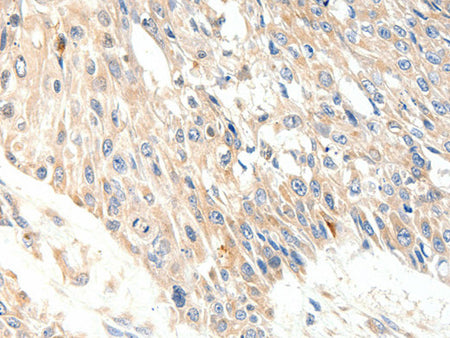 SLC27A1 Polyclonal Antibody Store at -20°C - Biomarkers - Elabscience Biotechnology - MSE Supplies