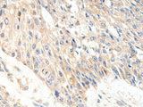 SLC27A1 Polyclonal Antibody Store at -20°C