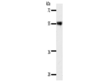 SLC32A1 Polyclonal Antibody Store at -20°C - Biomarkers - Elabscience Biotechnology - MSE Supplies