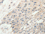 SLC9A7 Polyclonal Antibody Store at -20°C