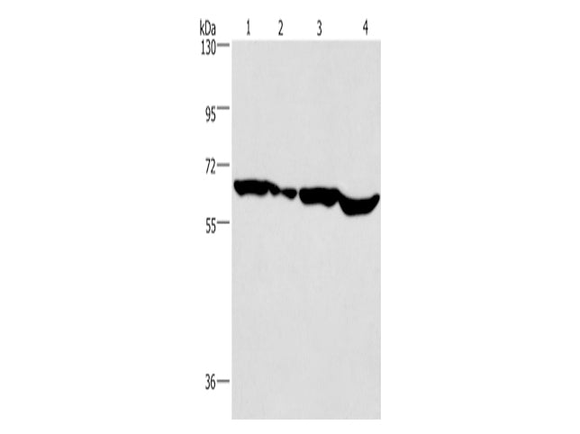 SOX-18 Polyclonal Antibody Store at -20°C - Biomarkers - Elabscience Biotechnology - MSE Supplies