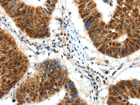 SP1 Polyclonal Antibody Store at -20°C - Biomarkers - Elabscience Biotechnology - MSE Supplies