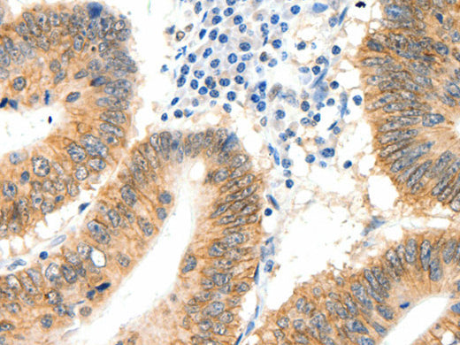 SIPA1 Polyclonal Antibody Store at -20°C - Biomarkers - Elabscience Biotechnology - MSE Supplies