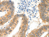 SIPA1 Polyclonal Antibody Store at -20°C