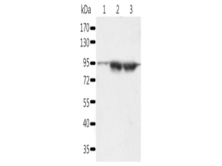 SPATA20 Polyclonal Antibody Store at -20°C - Biomarkers - Elabscience Biotechnology - MSE Supplies