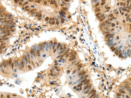 SSB Polyclonal Antibody Store at -20°C - Biomarkers - Elabscience Biotechnology - MSE Supplies