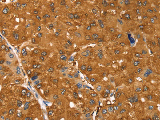 SSTR3 Polyclonal Antibody Store at -20°C - Biomarkers - Elabscience Biotechnology - MSE Supplies