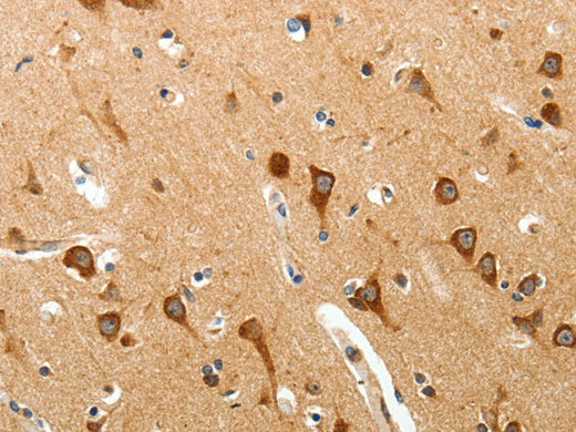 BIRC6 Polyclonal Antibody Store at -20°C - Biomarkers - Elabscience Biotechnology - MSE Supplies