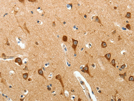 BIRC6 Polyclonal Antibody Store at -20°C - Biomarkers - Elabscience Biotechnology - MSE Supplies
