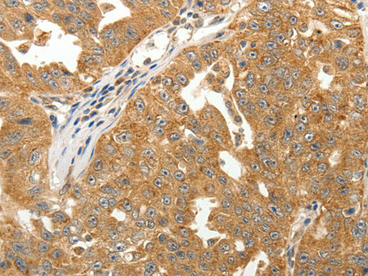 MAP1B Polyclonal Antibody Store at -20°C - Biomarkers - Elabscience Biotechnology - MSE Supplies