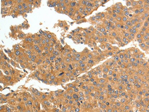 TNN Polyclonal Antibody Store at -20°C - Biomarkers - Elabscience Biotechnology - MSE Supplies