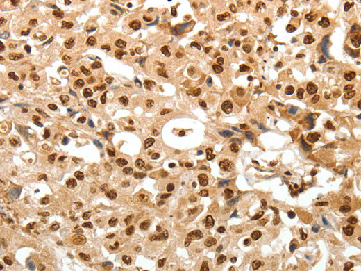 TNXB Polyclonal Antibody Store at -20°C - Biomarkers - Elabscience Biotechnology - MSE Supplies