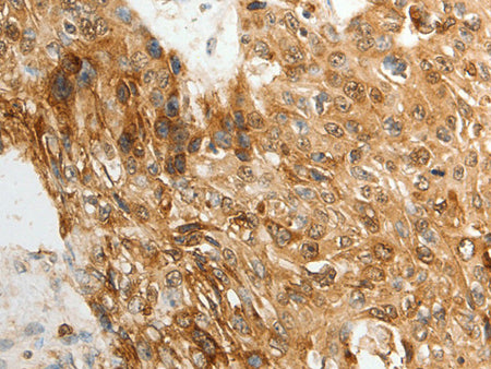 TENM3 Polyclonal Antibody Store at -20°C - Biomarkers - Elabscience Biotechnology - MSE Supplies