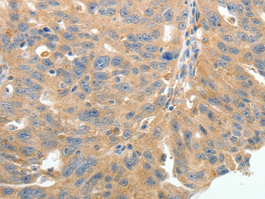 TERT Polyclonal Antibody Store at -20°C - Biomarkers - Elabscience Biotechnology - MSE Supplies
