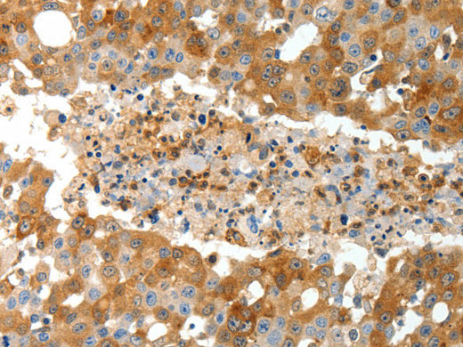 TEP1 Polyclonal Antibody Store at -20°C - Biomarkers - Elabscience Biotechnology - MSE Supplies