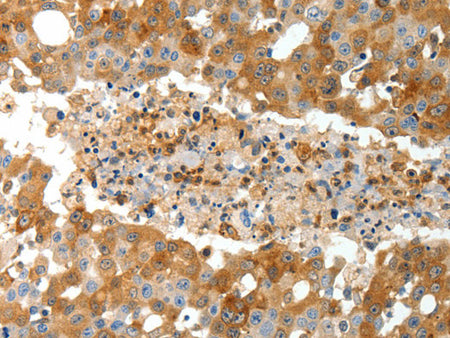 TEP1 Polyclonal Antibody Store at -20°C - Biomarkers - Elabscience Biotechnology - MSE Supplies
