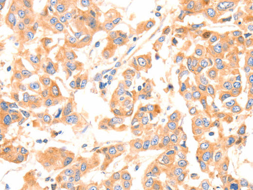 Factor XIIIa Polyclonal Antibody Store at -20°C - Biomarkers - Elabscience Biotechnology - MSE Supplies