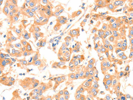 Factor XIIIa Polyclonal Antibody Store at -20°C - Biomarkers - Elabscience Biotechnology - MSE Supplies