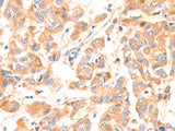 Factor XIIIa Polyclonal Antibody Store at -20°C