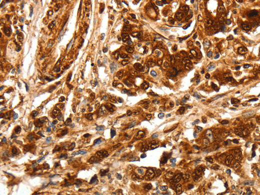 TGF β Receptor Polyclonal Antibody Store at -20°C - Biomarkers - Elabscience Biotechnology - MSE Supplies
