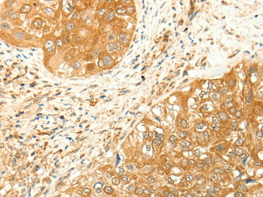 RARRES1 Polyclonal Antibody Store at -20°C - Biomarkers - Elabscience Biotechnology - MSE Supplies