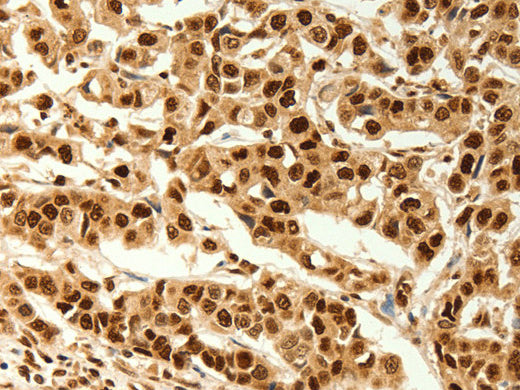 C12orf5 Polyclonal Antibody Store at -20°C - Biomarkers - Elabscience Biotechnology - MSE Supplies
