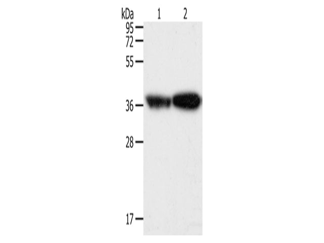 TPM2 Polyclonal Antibody Store at -20°C - Biomarkers - Elabscience Biotechnology - MSE Supplies