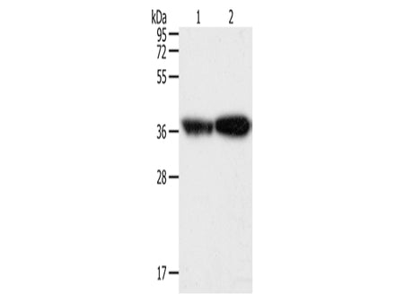TPM2 Polyclonal Antibody Store at -20°C - Biomarkers - Elabscience Biotechnology - MSE Supplies