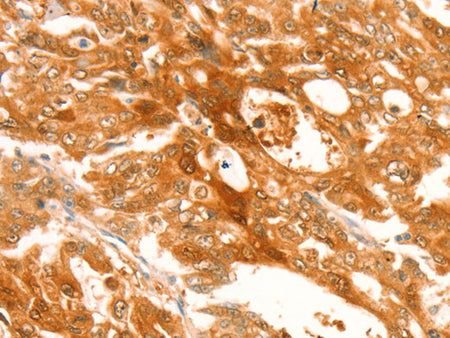 TRPM7 Polyclonal Antibody Store at -20°C - Biomarkers - Elabscience Biotechnology - MSE Supplies