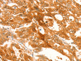 TRPM7 Polyclonal Antibody Store at -20°C
