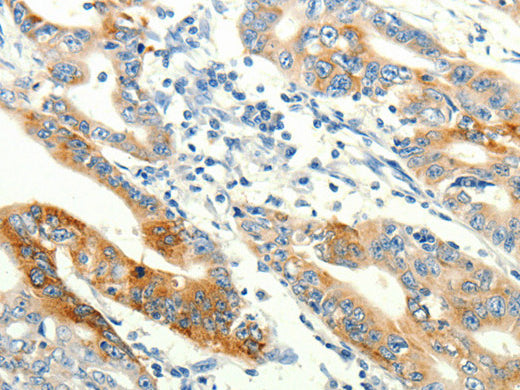 TRPA1 Polyclonal Antibody Store at -20°C - Biomarkers - Elabscience Biotechnology - MSE Supplies