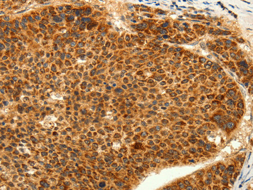 TRPC6 Polyclonal Antibody Store at -20°C - Biomarkers - Elabscience Biotechnology - MSE Supplies