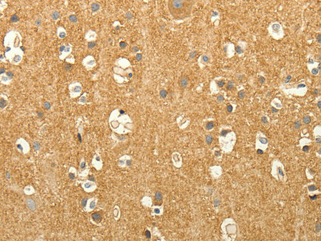 EDG7 Polyclonal Antibody Store at -20°C - Biomarkers - Elabscience Biotechnology - MSE Supplies