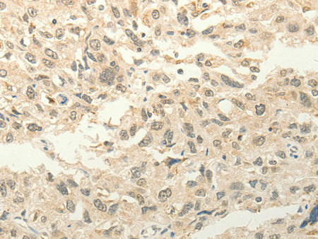 FZD8 Polyclonal Antibody Store at -20°C - Biomarkers - Elabscience Biotechnology - MSE Supplies