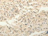 FZD8 Polyclonal Antibody Store at -20°C