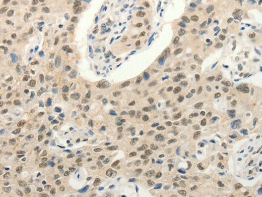 Frizzled 10 Polyclonal Antibody Store at -20°C - Biomarkers - Elabscience Biotechnology - MSE Supplies