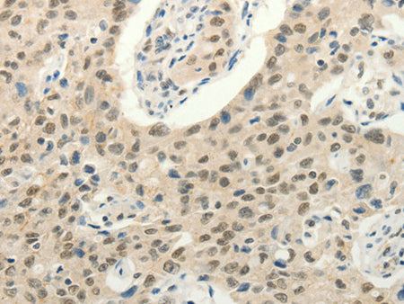 Frizzled 10 Polyclonal Antibody Store at -20°C - Biomarkers - Elabscience Biotechnology - MSE Supplies