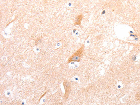 CELSR2 Polyclonal Antibody Store at -20°C - Biomarkers - Elabscience Biotechnology - MSE Supplies