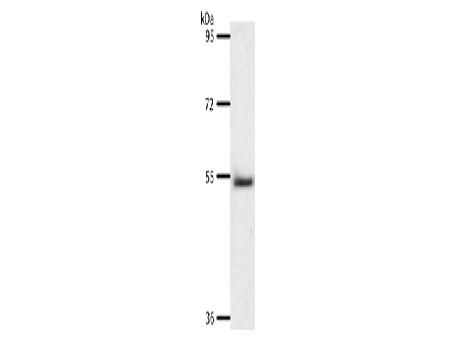 A1BG Polyclonal Antibody Store at -20°C - Biomarkers - Elabscience Biotechnology - MSE Supplies